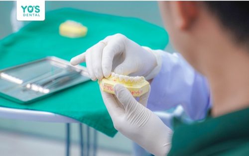 Phục hồi răng đã mất sớm để bảo vệ sức khỏe và thẩm mỹ nụ cười cay-ghep-implant-yos-dental-3.jpg